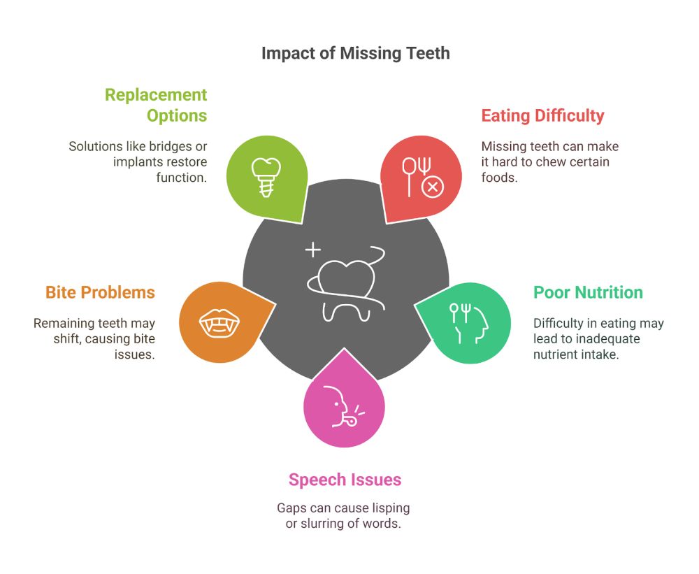 Consequences Of Not Replacing Missing Teeth