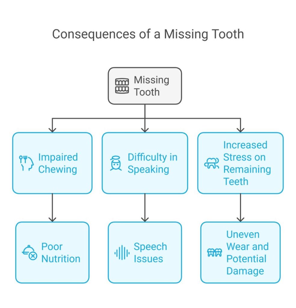 Reasons To Replace A Missing Single Tooth