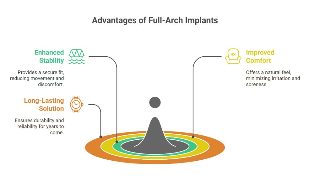 Benefits Of Full Arch Dental Implants Over Traditional Dentures