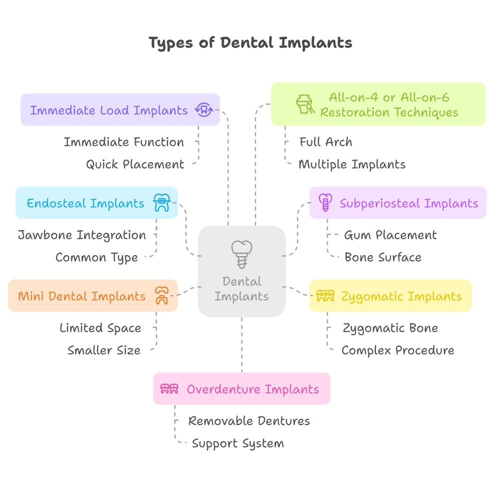 Types of Dental Implants Available in West Palm Beach