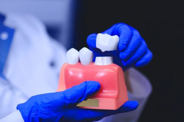 Dental Implants in Lake Worth, FL – Restore Your Smile with West Palm Beach Family Dental