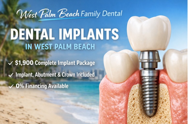 Dental Implants