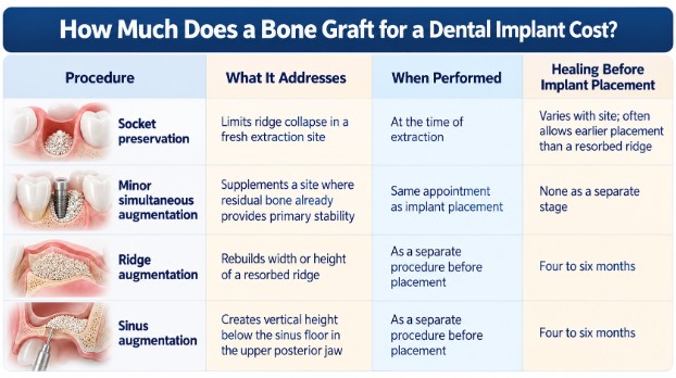 How Much Does a Bone Graft for a Dental Implant Cost?